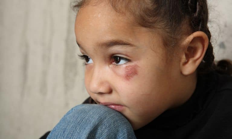 odessa child abuse lawyer